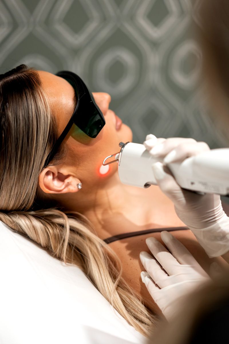 Woman receiving cosmetic laser treatment on her face.